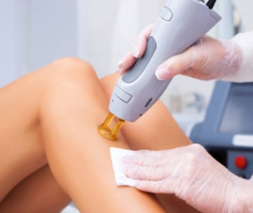 Laser hair  removal